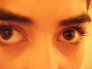 Eyes and Dark Circles