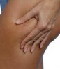 Cellulite affects Desi women too