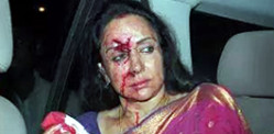 Bollywood's Hema Malini injured in Fatal Accident