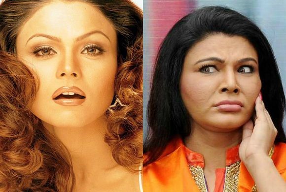 Bollywood Stars Before and After Cosmetic Surgery
