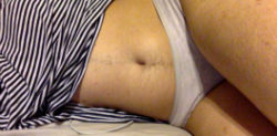 Suraiya Ali trolled on Twitter for having Body Hair