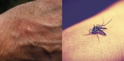 10 Facts about Malaria you Need to Know