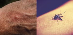 10 Facts about Malaria you Need to Know