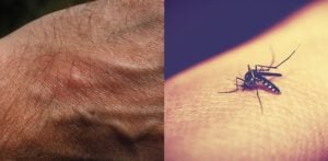 10 Facts about Malaria you Need to Know