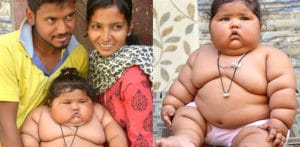 Indian Girl aged 8 months weighs 17kg & Doctors Baffled Why - f