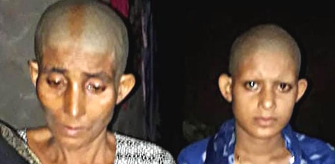 Indian Mother and Daughter's Head Shaved for Resisting Rape f