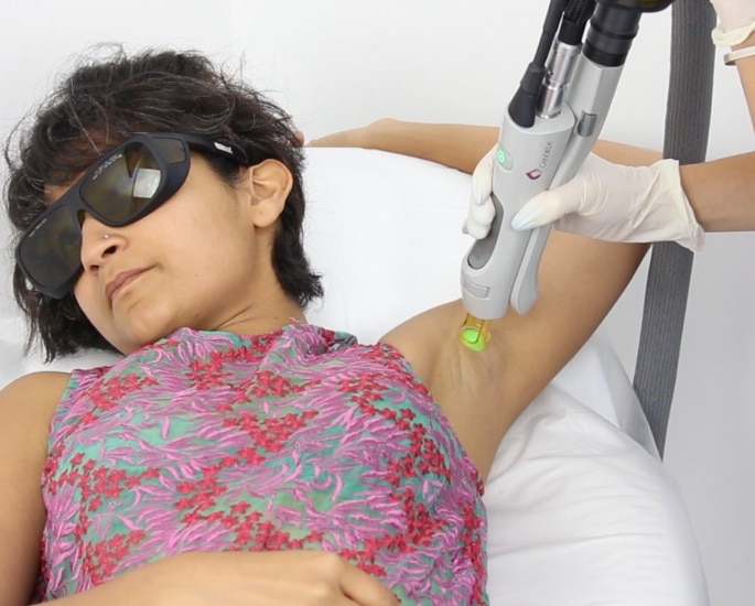 Is Laser Hair Removal Worth it for Asian Hair - laser hair