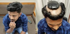Indian Man tried to Smuggle 1kg Gold Under a Wig f