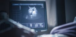 Drunk Doctor Molests Pregnant Woman during Ultrasound
