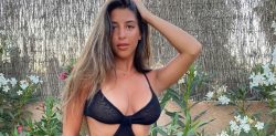 Shannon Singh trolled for having ‘Shark Teeth’