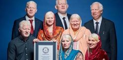 Albino Family honoured with Guinness World Record f