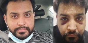 Uber Driver assaulted in Racist Attack on Christmas Day f