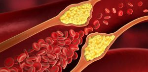 5 Ways to Reduce Cholesterol in Winter f