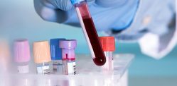 Indian Startup develops AI Blood Test to Detect Cancer Early f