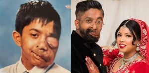 Amit Ghose: Visually Different, Bullied at School & Inspiring a Generation