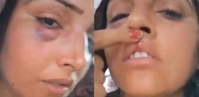Was Seema Haider beaten by her Indian Husband f