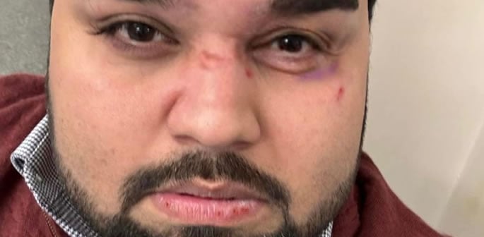 Uber Driver left Injured after Violent 'Racially Motivated' Attack f