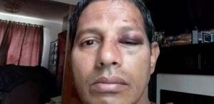 Chef Beaten & Robbed as Anti-Indian Attacks in Ireland Surge f