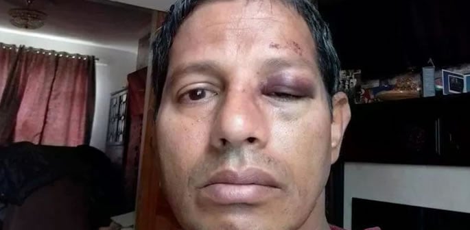 Chef Beaten & Robbed as Anti-Indian Attacks in Ireland Surge f