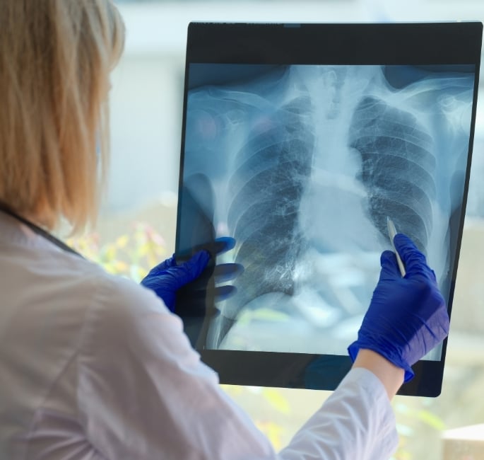 The Link Between Smoking and South Asian Health Conditions (2)