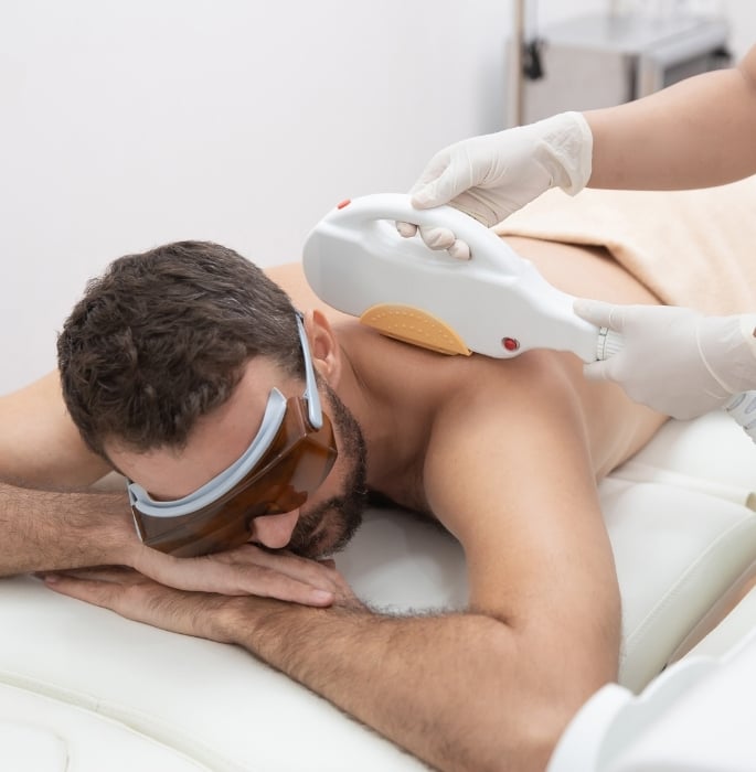 Why More Men are Turning to Laser Hair Removal 