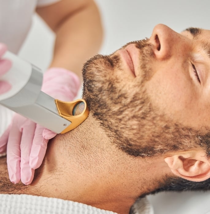 Why More Men are Turning to Laser Hair Removal 