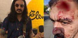 Ex-Zutons Guitarist ‘Could Have Been Killed’ in Racist Attack