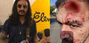 Ex-Zutons Guitarist 'Could Have Been Killed' in Racist Attack f