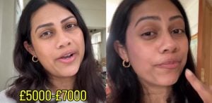 Influencer warns Migrants about High UK Dental Implant Prices F