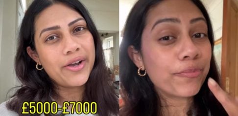 Influencer warns Migrants about High UK Dental Implant Prices F
