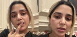 Aima Baig's Bruise Sparks Domestic Violence Rumours Aima Baig's Bruise Sparks Domestic Violence Rumours f