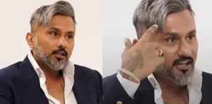 Why Yo Yo Honey Singh is Totally Bald f